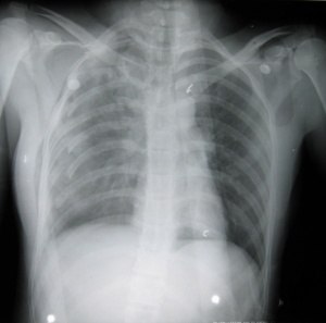 Aimees's Xray1-851869-edited.jpg