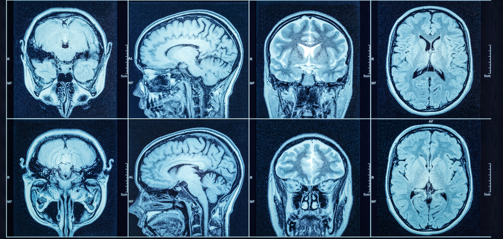 CT scan example