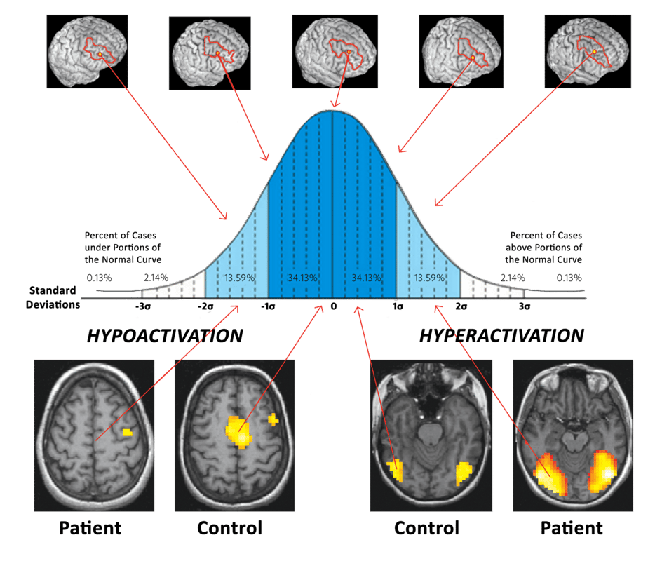 Neurocognitive Assessment & Rehabilitation Cognitive FX