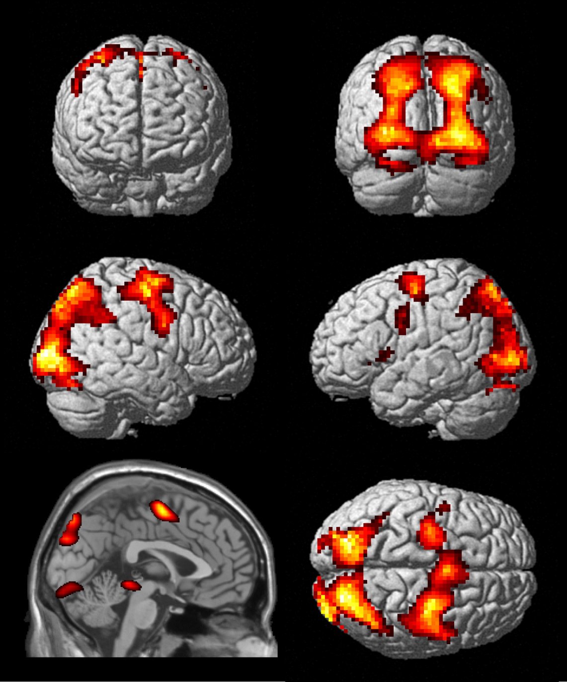 EPIC Concussion Treatment Cognitive FX Treatment Center