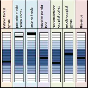 Epic-Concussion-Treatment-Graph-300x300