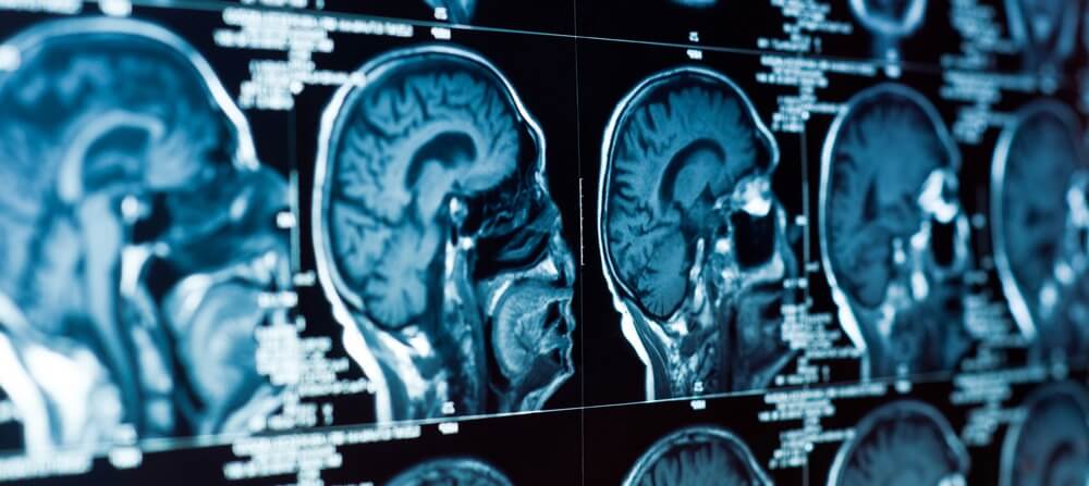 CT scans can help diagnose head injury.