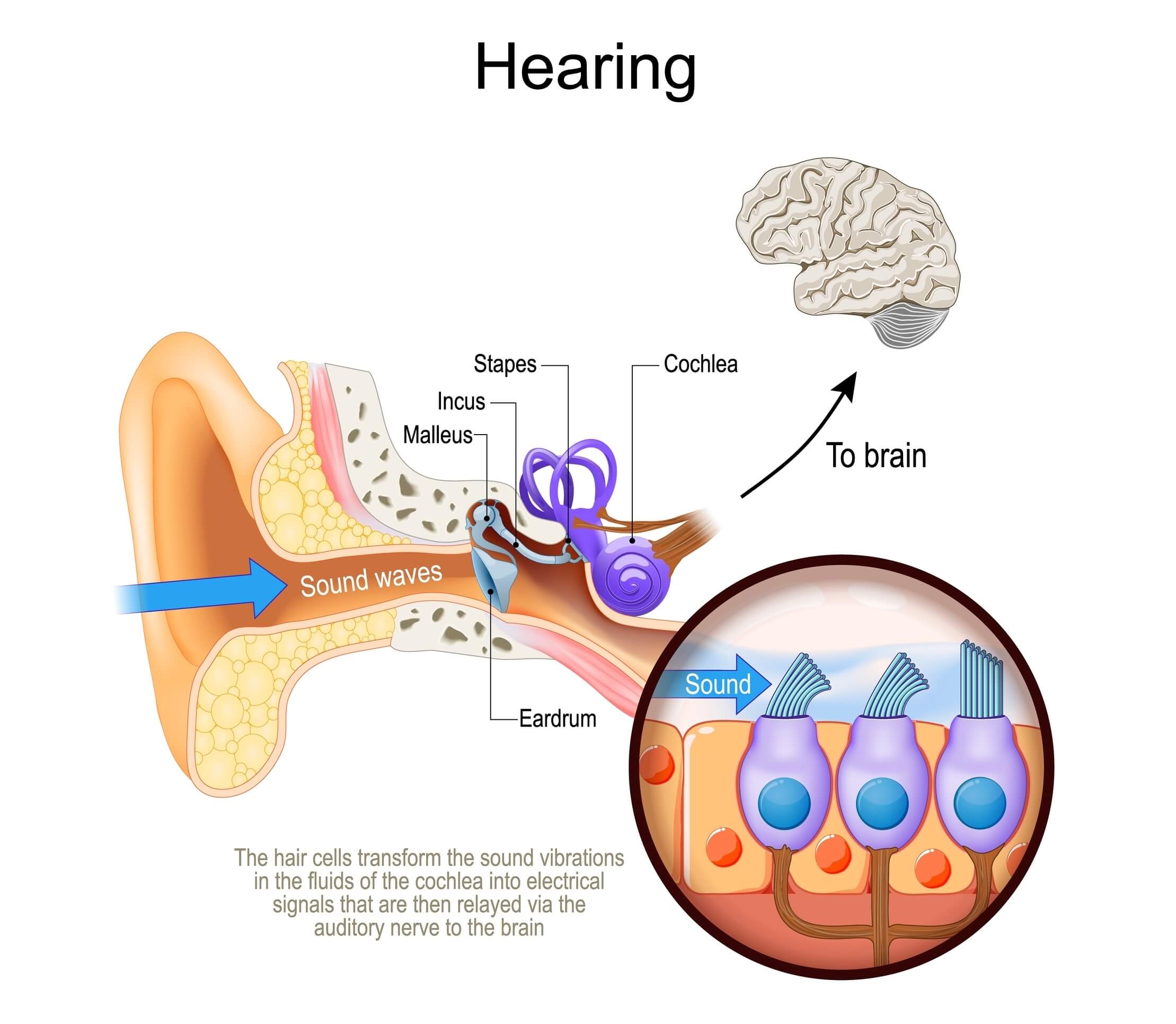Sound travels through the ear canal to the eardrum, causing vibrations. Middle ear bones amplify and send them to the cochlea, where hair cells turn them into electrical signals. The auditory nerve sends these to the brain, which interprets them as sound.