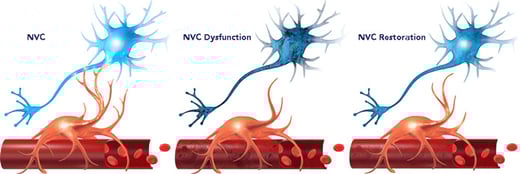 NVC-Process