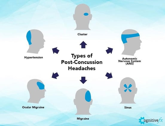 Tension Headache: What It Is, Causes, Symptoms & Treatment