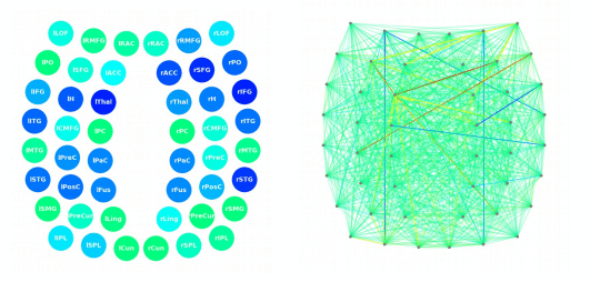 Diagram showing brain connections and communication. 