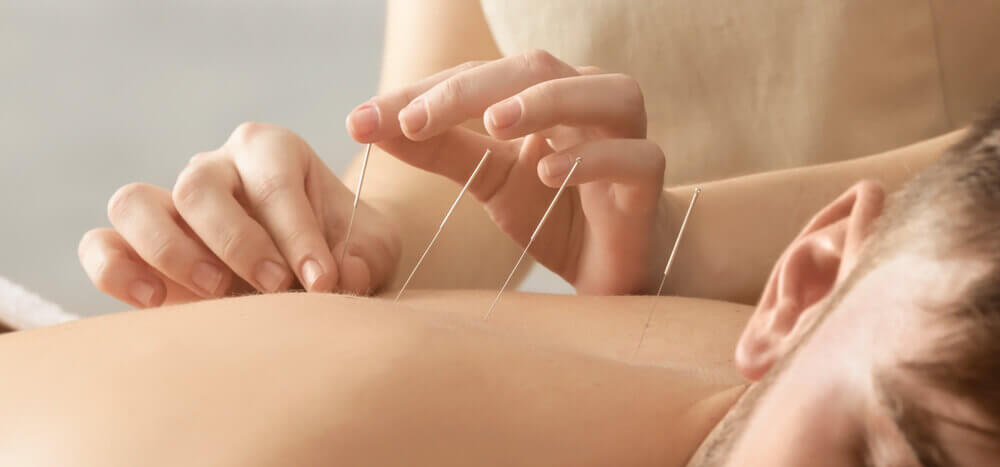 Image of someone relaxing while receiving acupuncture