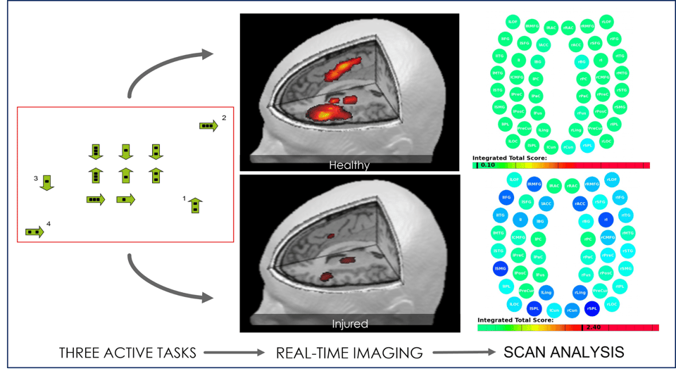 Diagram of the fNCI process: active cognitive tasks, real-time imaging, scan analysis