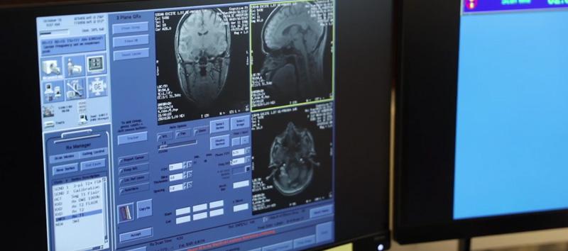 A regular MRI usually cannot detect post-concussion syndrome, but fNCI (functional Neurocognitive Imaging) can.