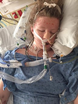 can-you-recover-from-tbi-patient-story-5