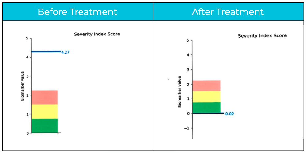 Anthony's Severity Index Score was 4.27 before the treatment and -0.02 afterwards.
