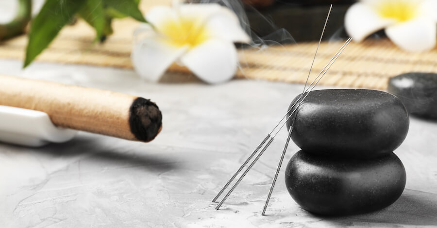 Acupuncture needles and hot stones