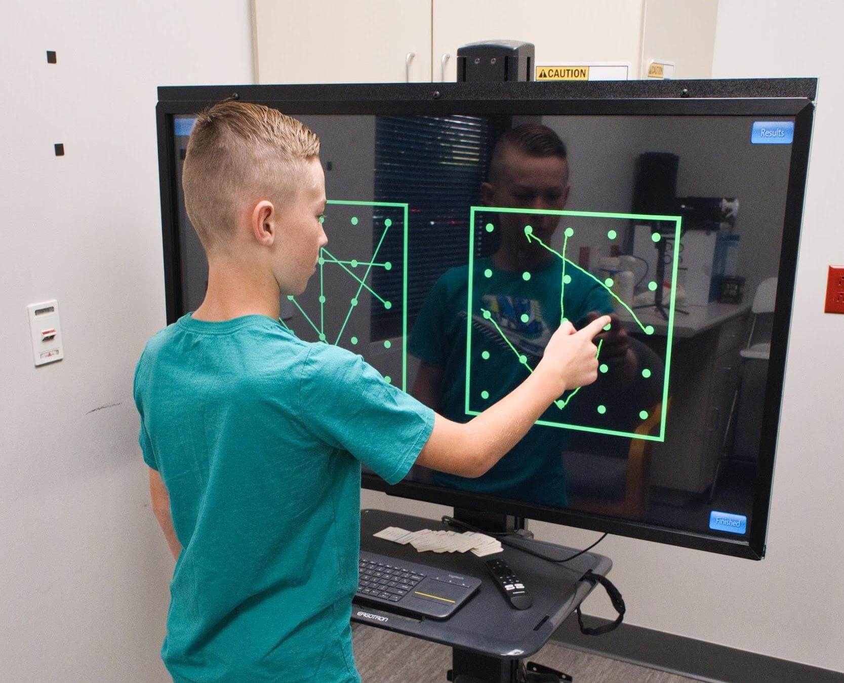 PostConcussion Syndrome Dizziness Causes & Treatment