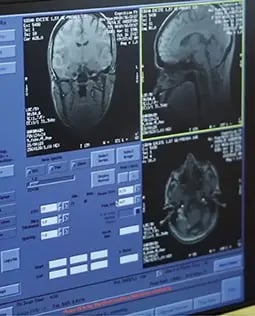 fNCI Brain Scan in Progress