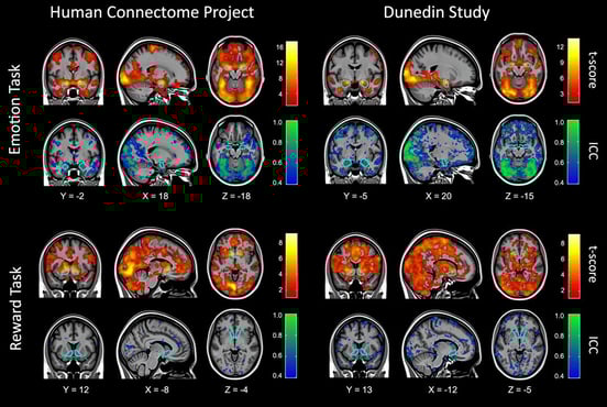 fmri-brain-scans-duke-study-implications-1