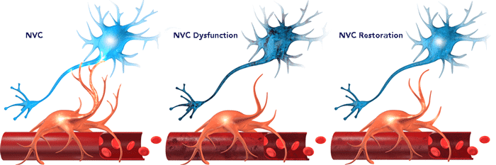 Neurovascular Couping vs NVC Dysfunction vs NVC Restoration