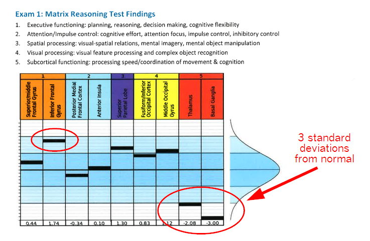 fMRI Matrix Reasoning Test Findings for Olivia