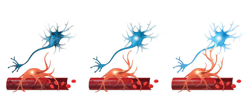 A visual of neurovascular coupling dysfunction. 