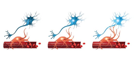 how-to-reverse-chemo-brain-1