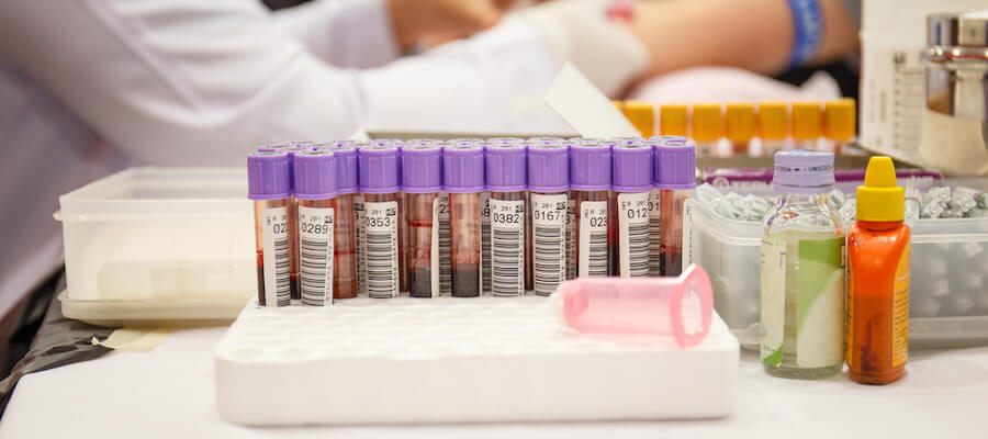 A photo showing many vials of blood that's been drawn.