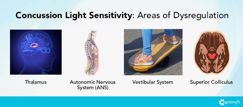 Concussion Light Sensitivity: Areas of Dysregulation include the Thalamus, the Autonomic Nervous System, the Vestibular System, and the Superior Colliculus.