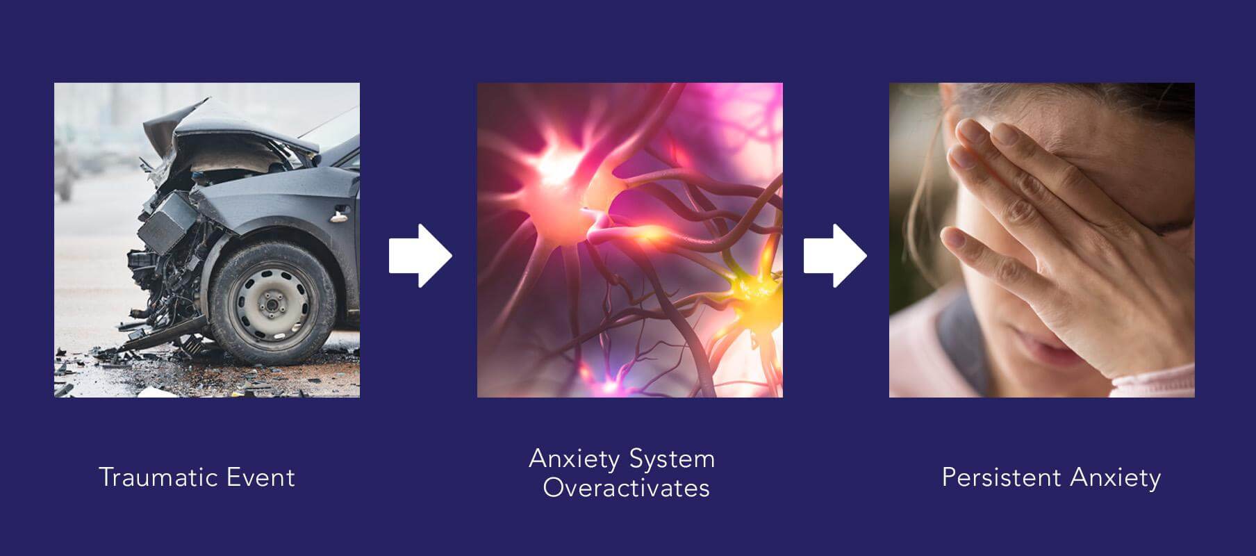 A traumatic even causes the anxiety system to overactivate and may cause persistent anxiety.