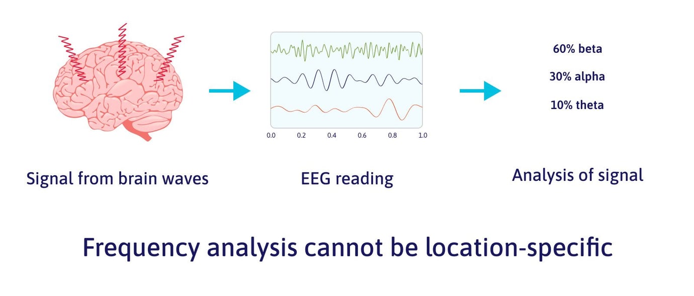 Neurofeedback for PostConcussion Syndrome Cognitive FX