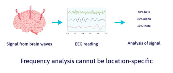 neurofeedback-for-post-concussion-syndrome-4