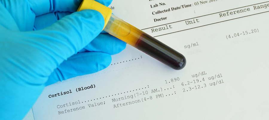 A vial of blood is being held on top of blood result paperwork.