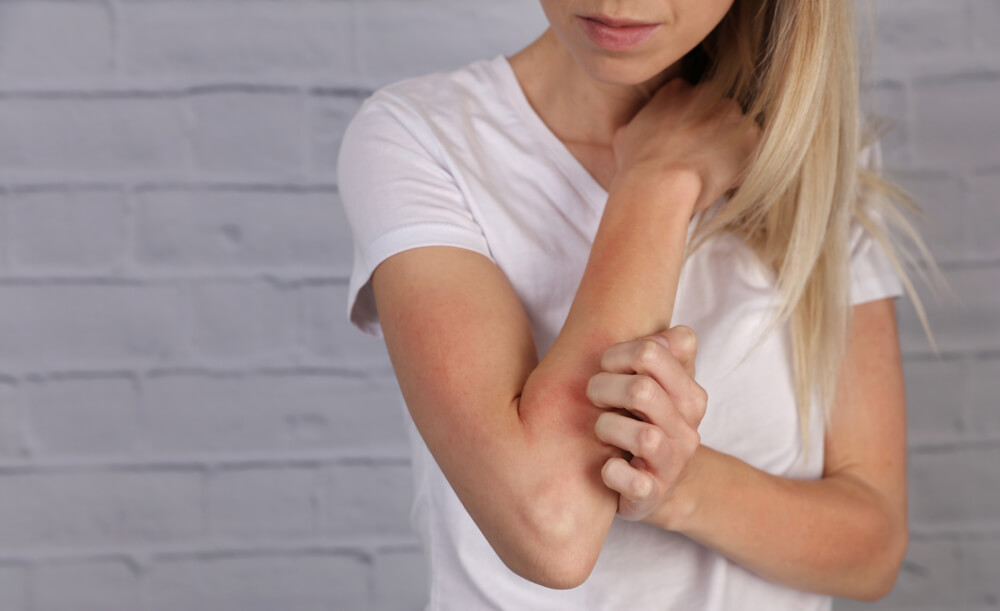 A woman is having an allergic reaction to medication and itching her arm.