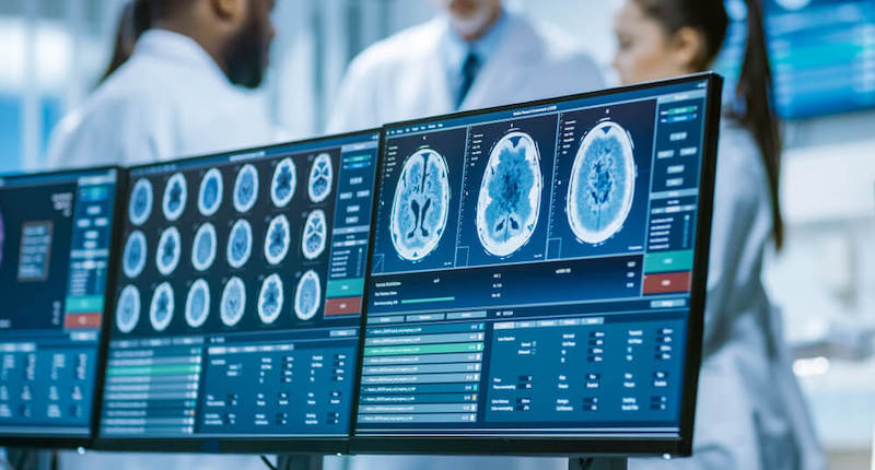 3 computer screens showing different CT Scans.