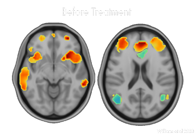 woman-with-headphone