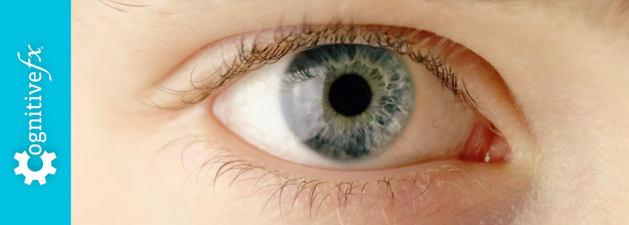 Post-Concussion Syndrome Eye Twitching
